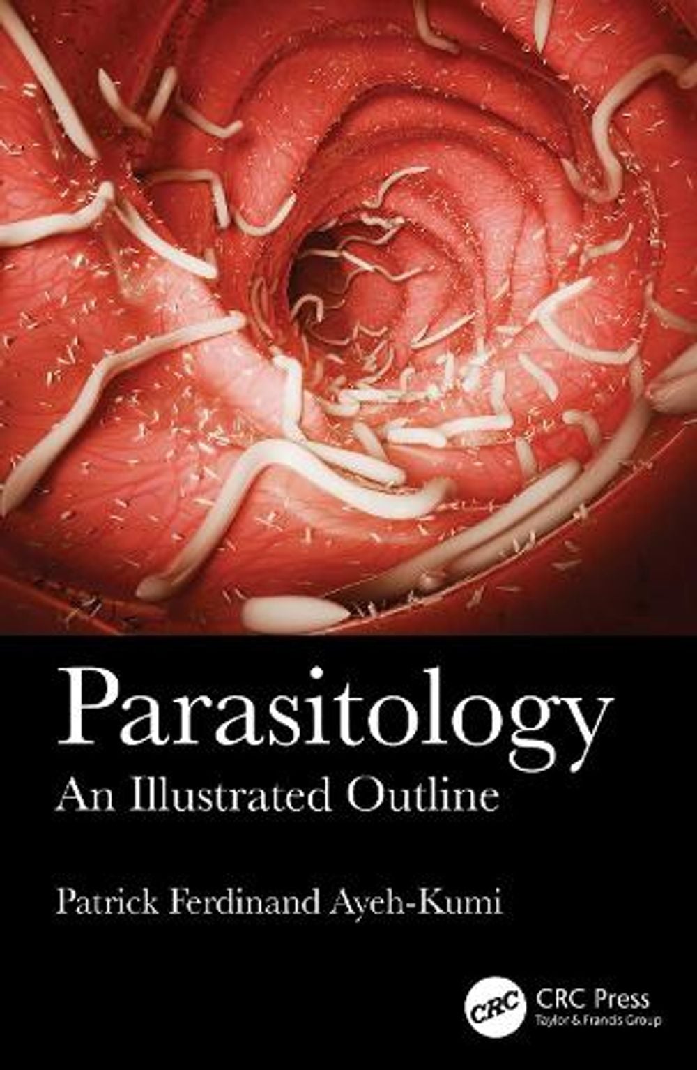 Parasitology by Patrick Ferdinand Ayeh-Kumi - ISBN: 9781041223986