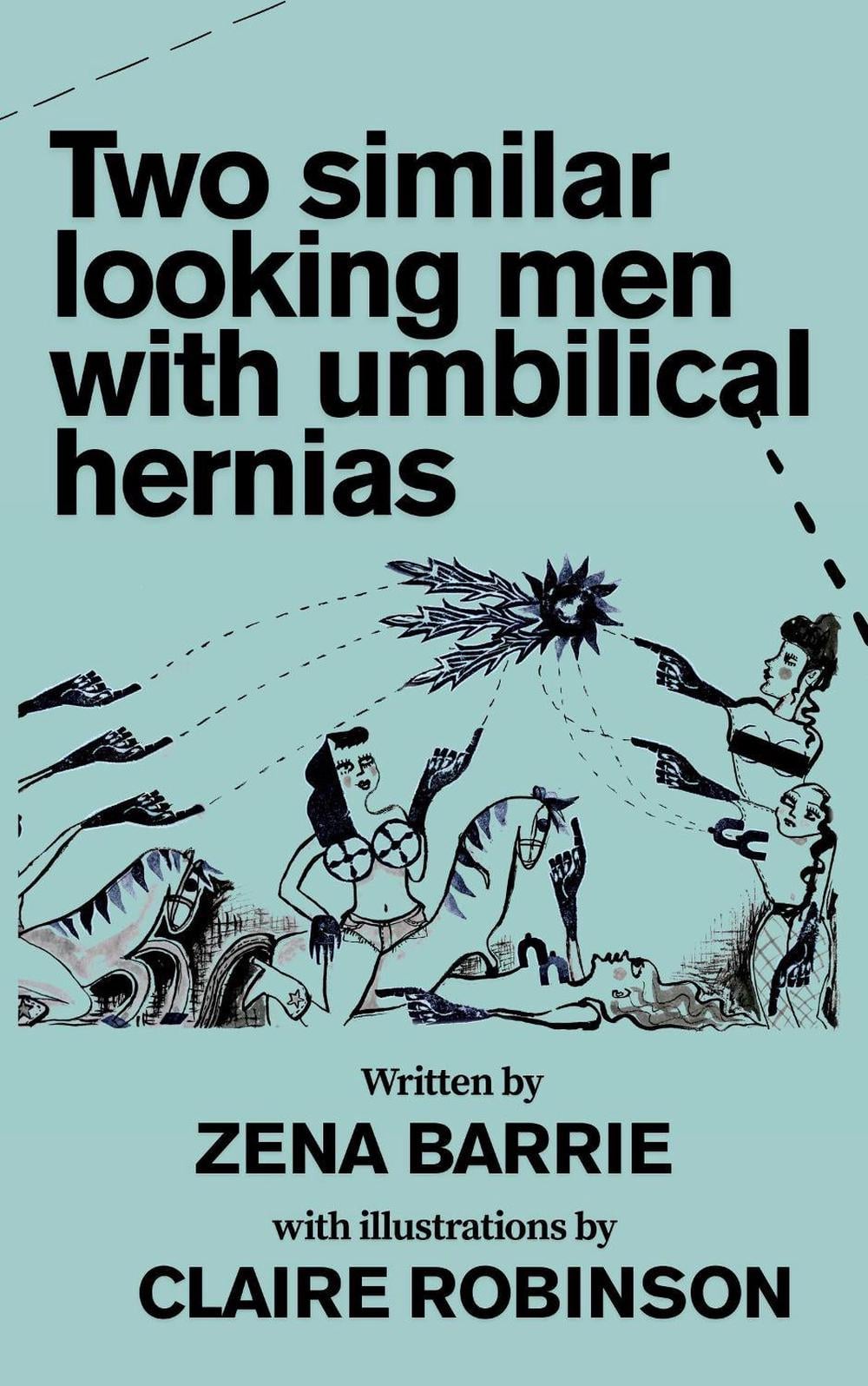 Two Similar Looking Men With Umbilical Hernias by Zena Barrie ...