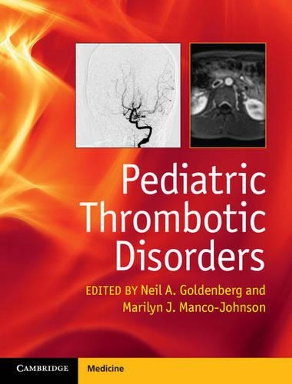 Pediatric Thrombotic Disorders by Neil A. Goldenberg - ISBN: 9781107014541