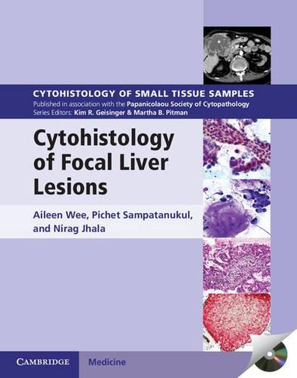 Cytohistology of Focal Liver Lesions, 9781107024175