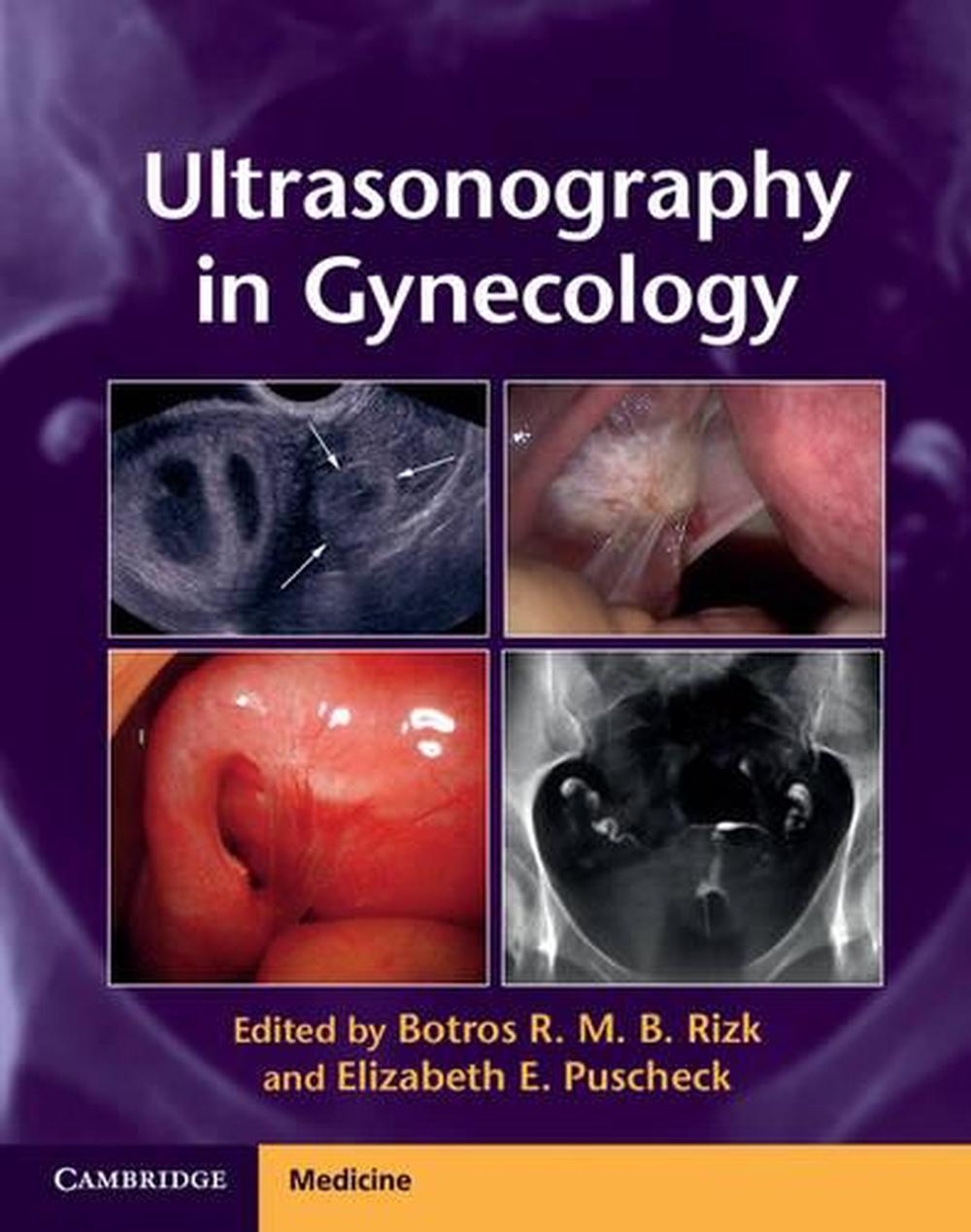 Ultrasonography in Gynecology, 9781107029743