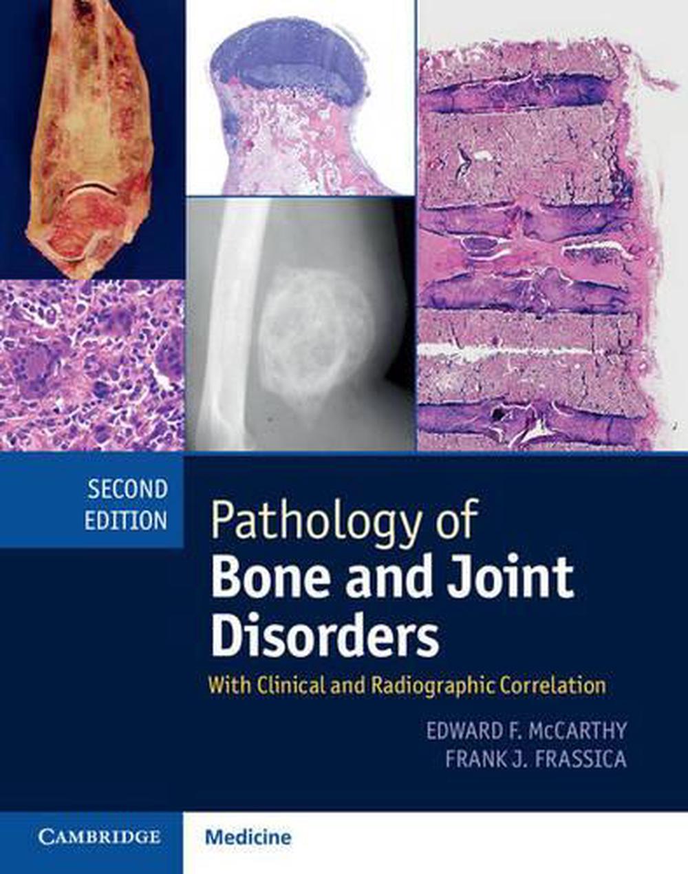 Pathology of Bone and Joint Disorders Print and Online Bundle by Edward