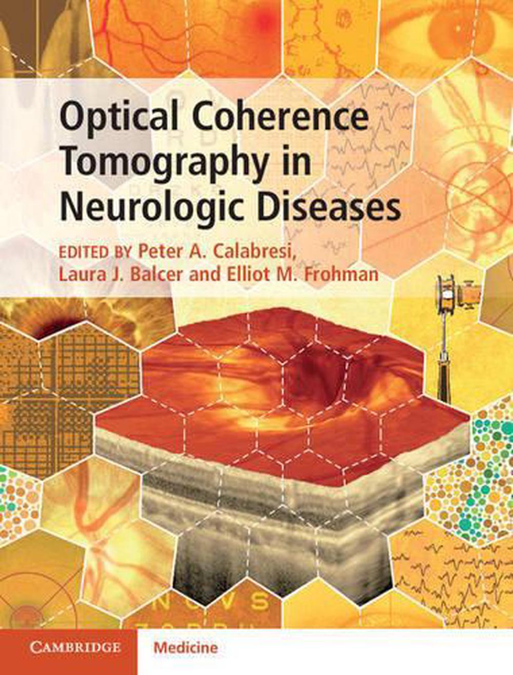 Optical Coherence Tomography in Neurologic Diseases, 9781107041301