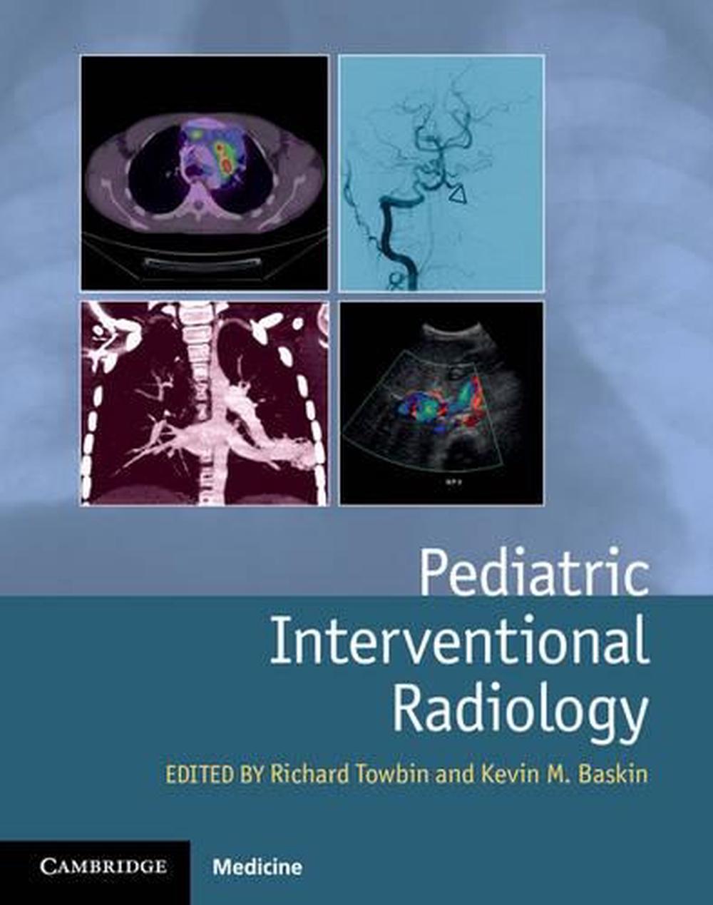 Pediatric Interventional Radiology, 9781107042629