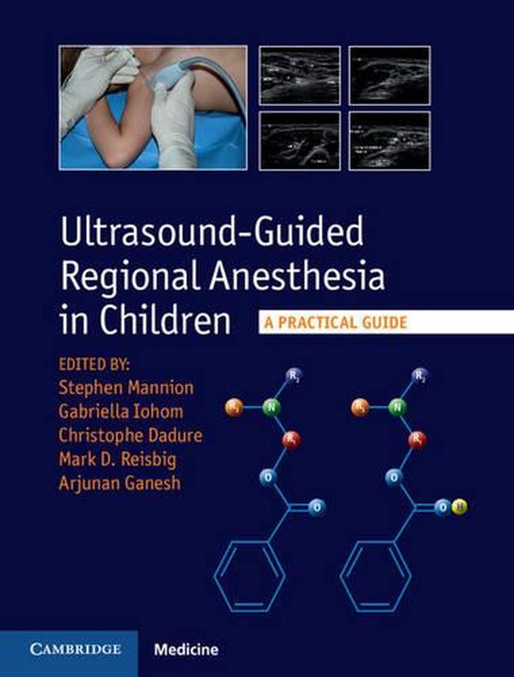 Ultrasound-Guided Regional Anesthesia in Children, 9781107098770