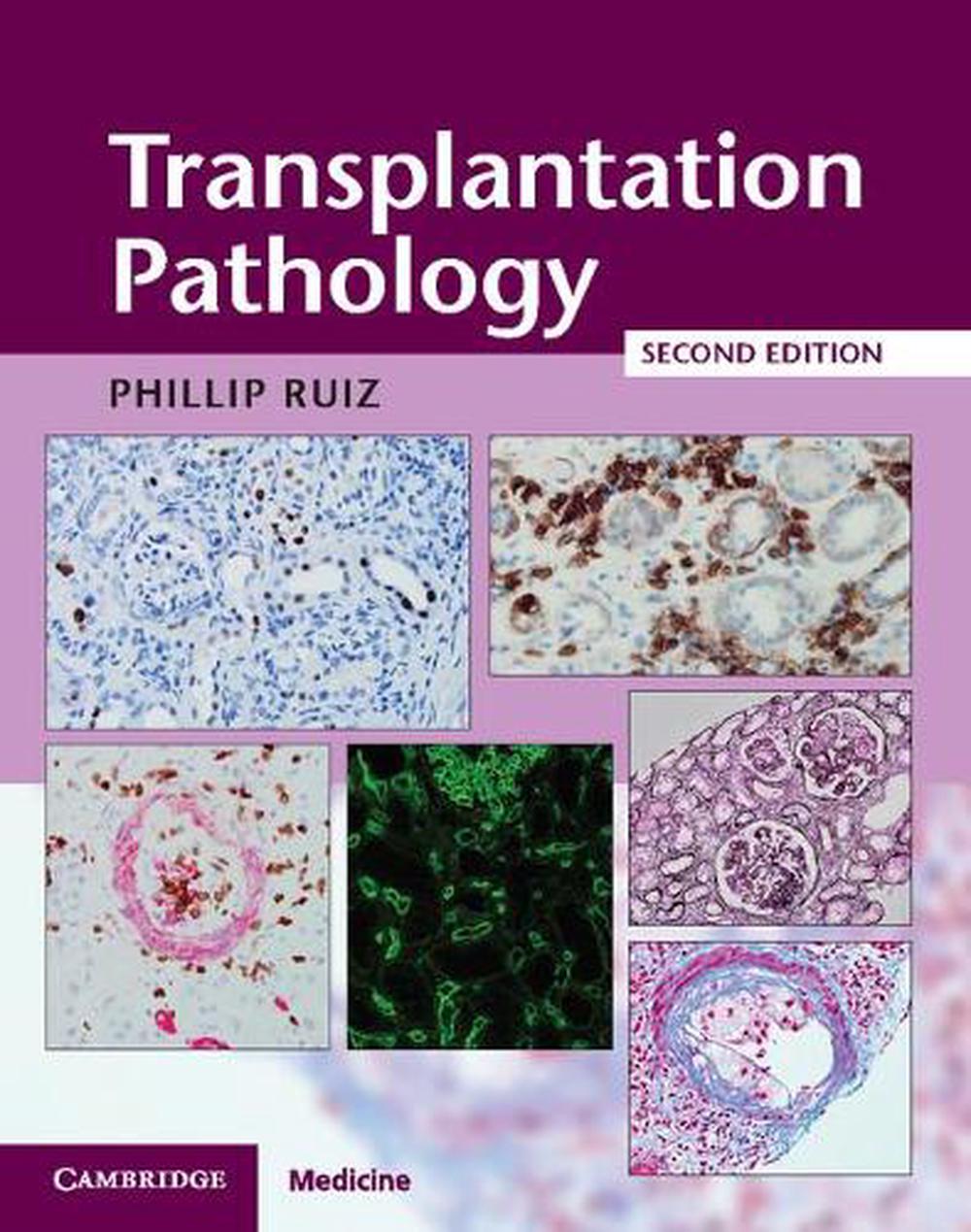 Transplantation Pathology Hardback with Online Resource, 9781107443280