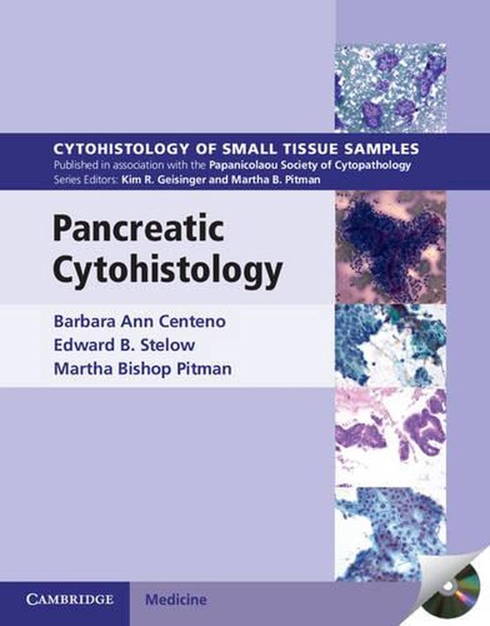 Pancreatic Cytohistology, 9781107518308