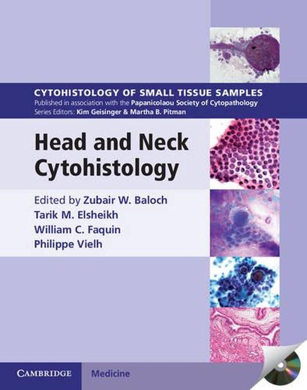 Head and Neck Cytohistology with DVD-ROM, 9781107669888
