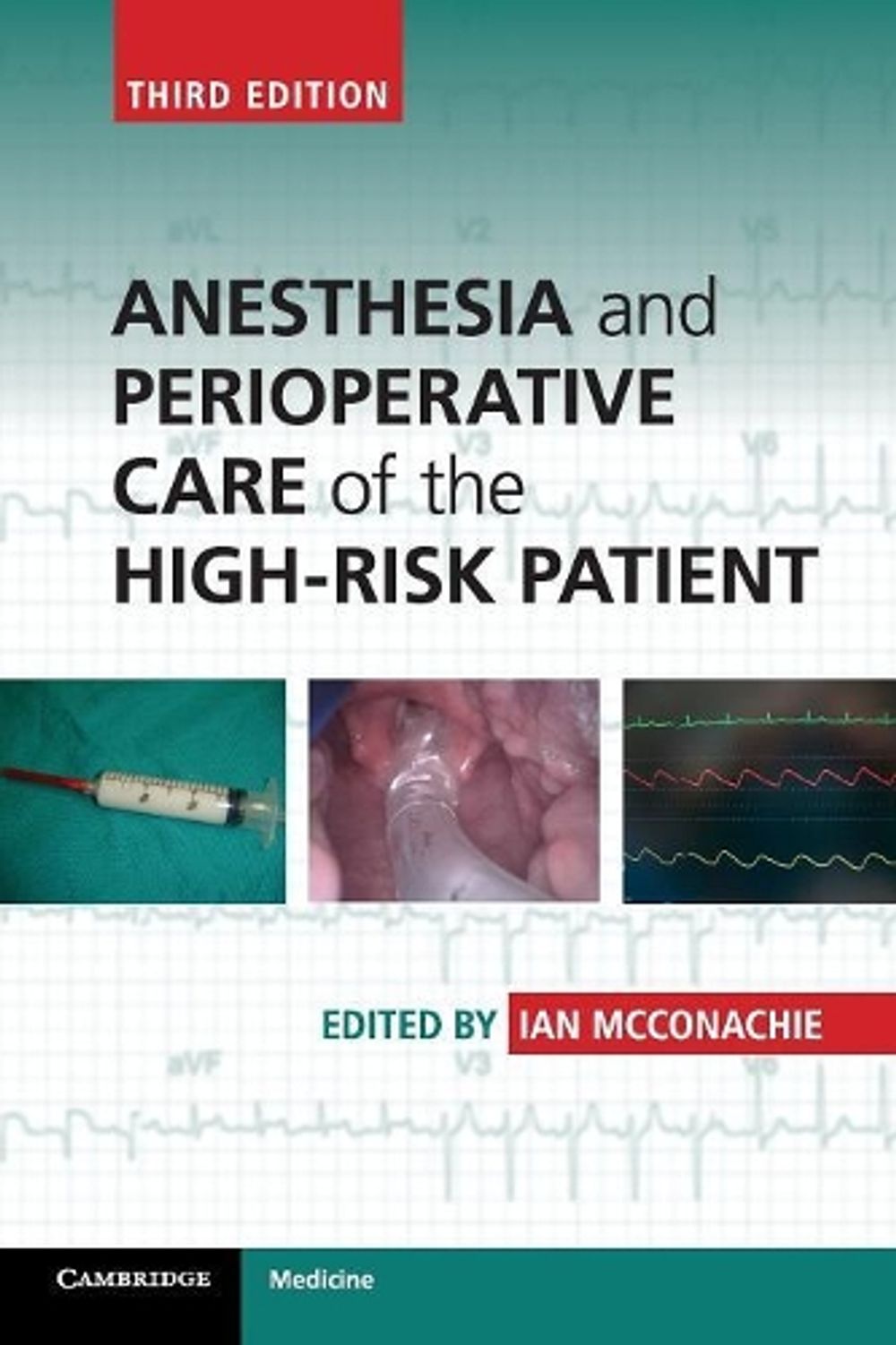 Anesthesia and Perioperative Care of the High-Risk Patient by Ian McConachie - ISBN: 9781107690578