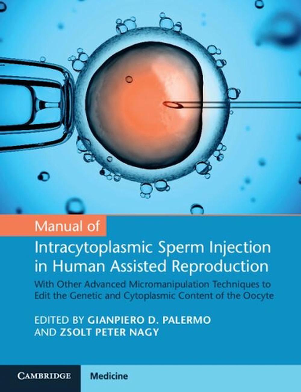 Manual of Intracytoplasmic Sperm Injection in Human Assisted Reproduction, 9781108743839