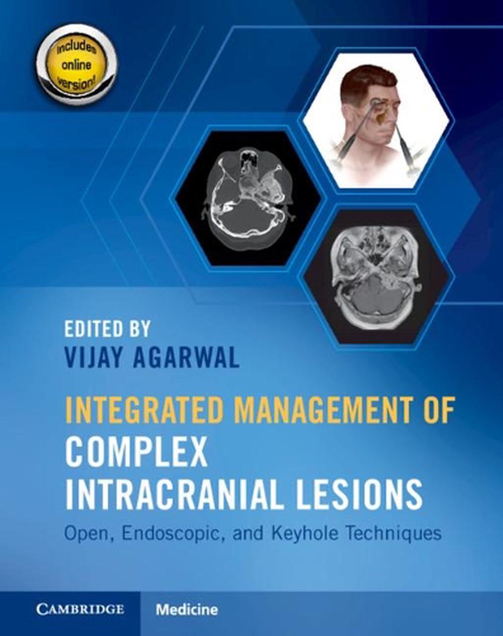Integrated Management of Complex Intracranial Lesions Hardback Set and Static Online Product, 9781108782838