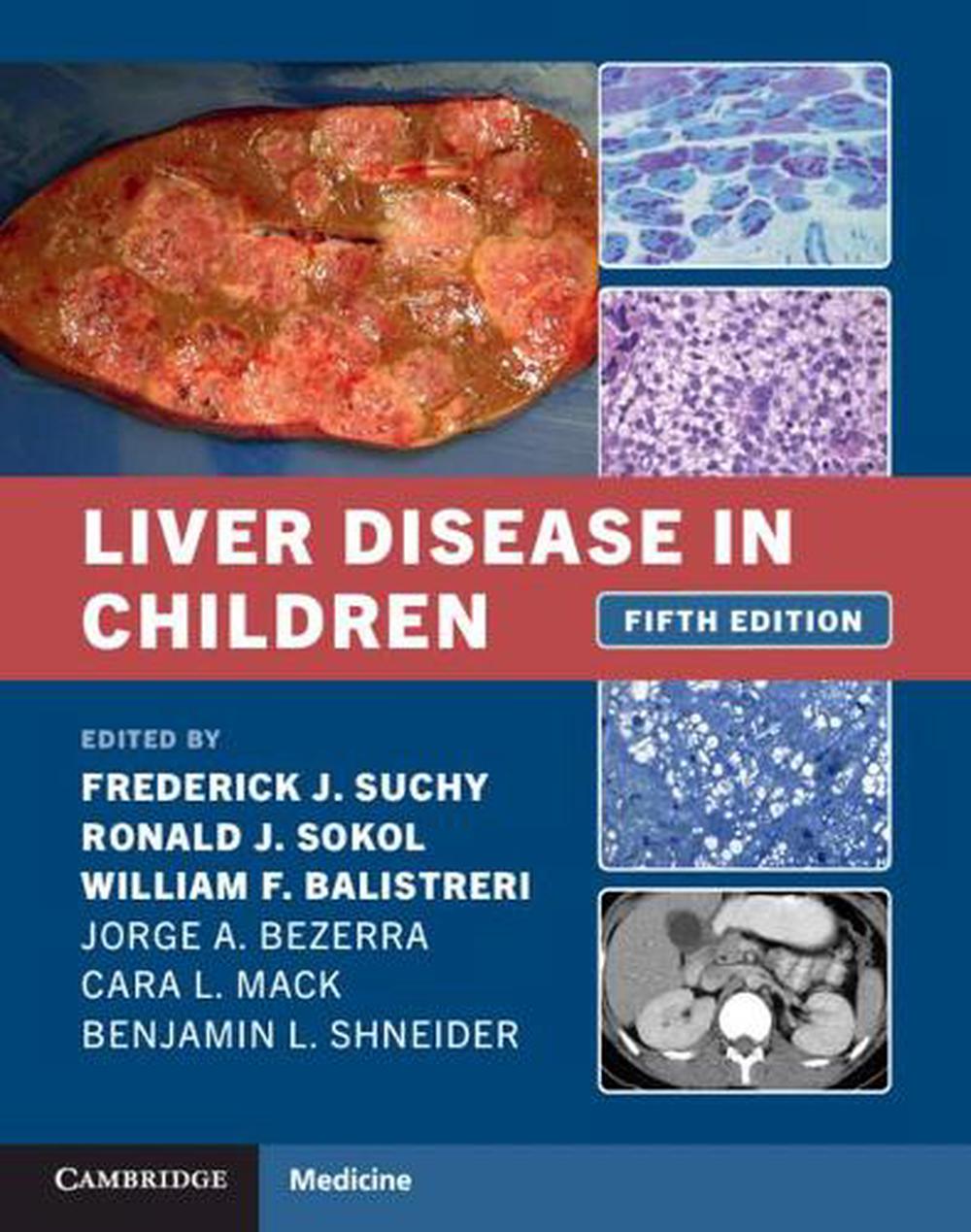 Liver Disease in Children, 9781108843515