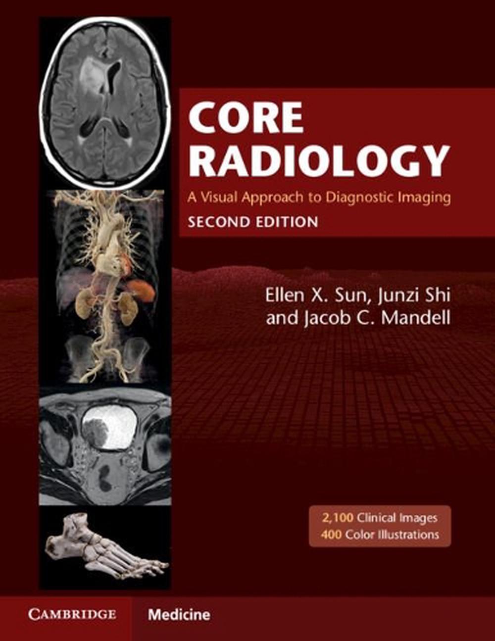 Core Radiology, 9781108965910