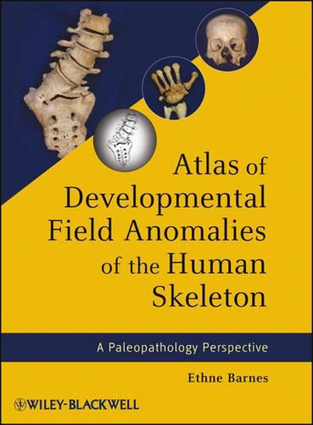 Atlas of Developmental Field Anomalies of the Human Skeleton, 1st Edition, 9781118013885