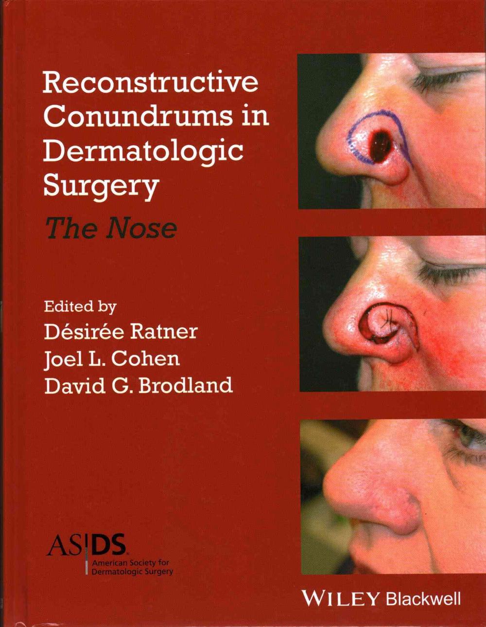 Reconstructive Conundrums in Dermatologic Surgery, 9781118272329