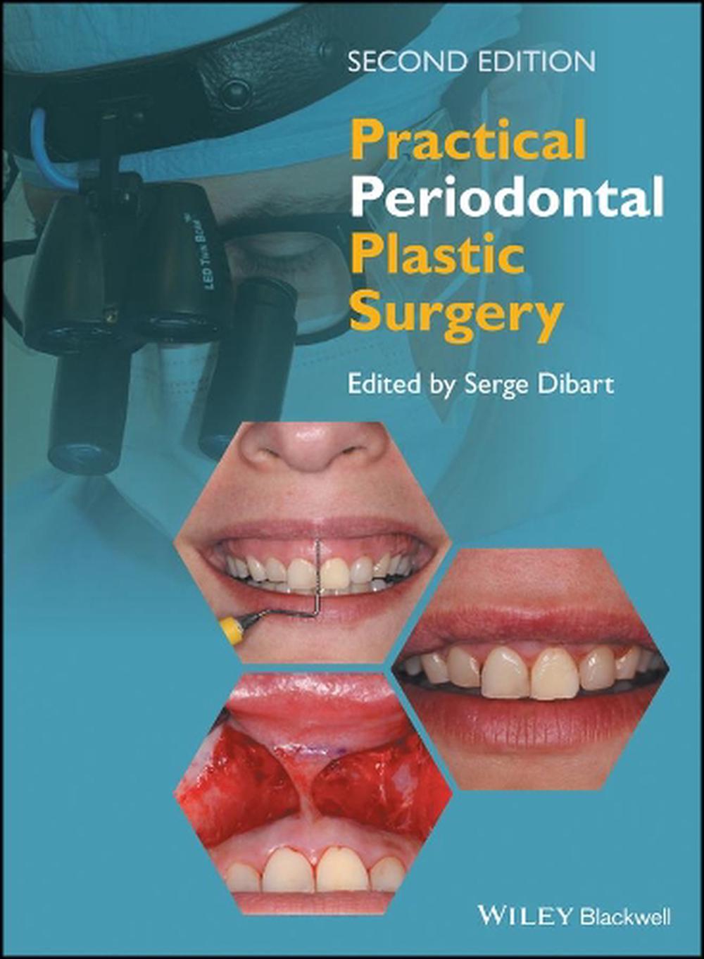 Practical Periodontal Plastic Surgery, 2nd Edition, 9781118360651