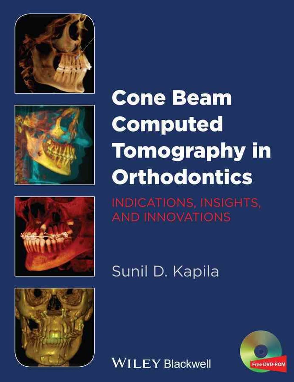 Cone Beam Computed Tomography in Orthodontics, 1st Edition by Sunil D ...