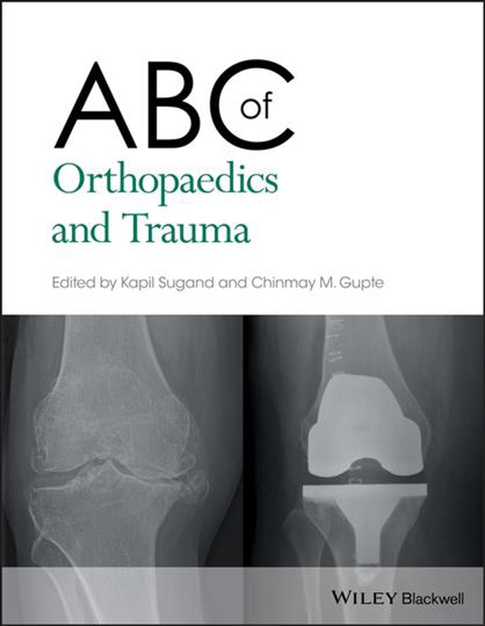 ABC of Orthopaedics and Trauma, 9781118561225
