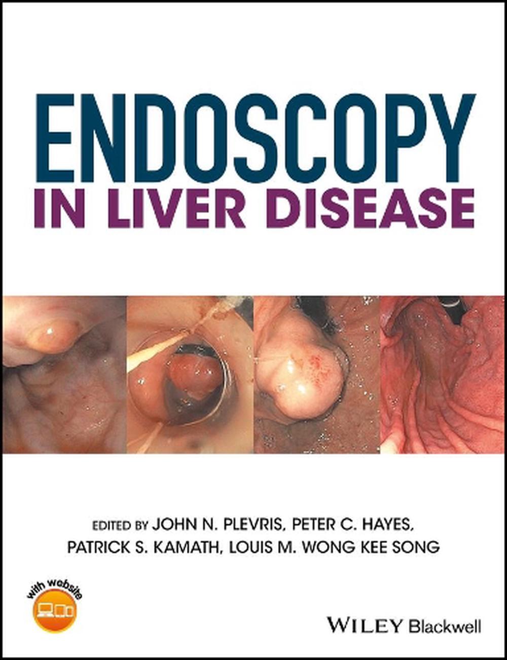 Endoscopy in Liver Disease, 1st Edition, 9781118660874
