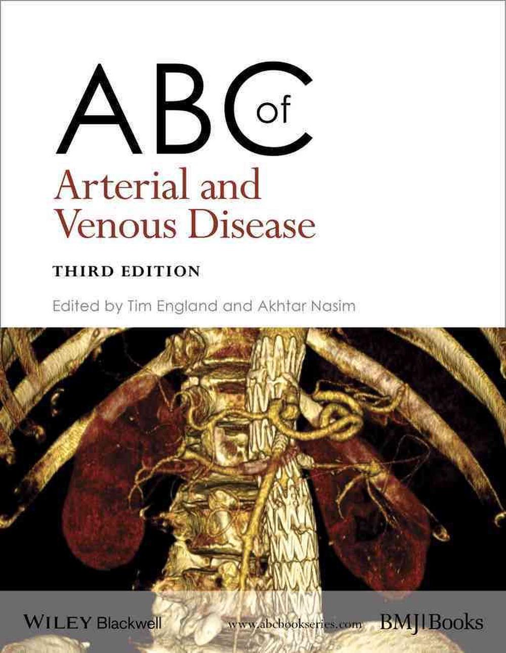 ABC of Arterial and Venous Disease, 9781118740682