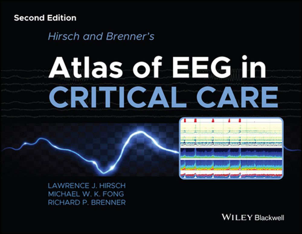 Hirsch and Brenner's Atlas of EEG in Critical Care, 2nd Edition by Lawrence J. Hirsch - ISBN: 9781118752890