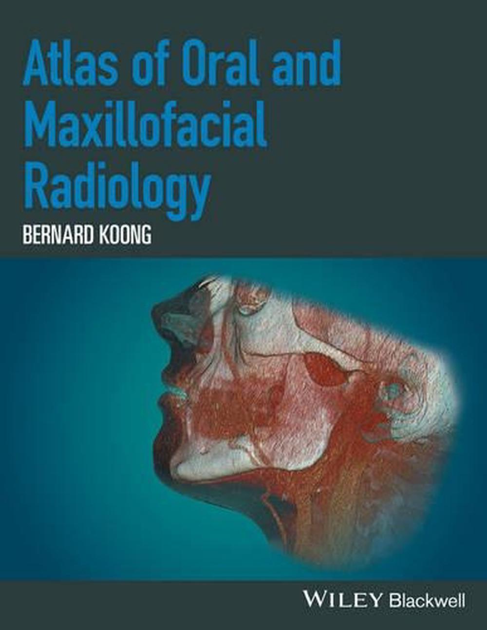 Atlas of Oral and Maxillofacial Radiology, 1st Edition, 9781118939642