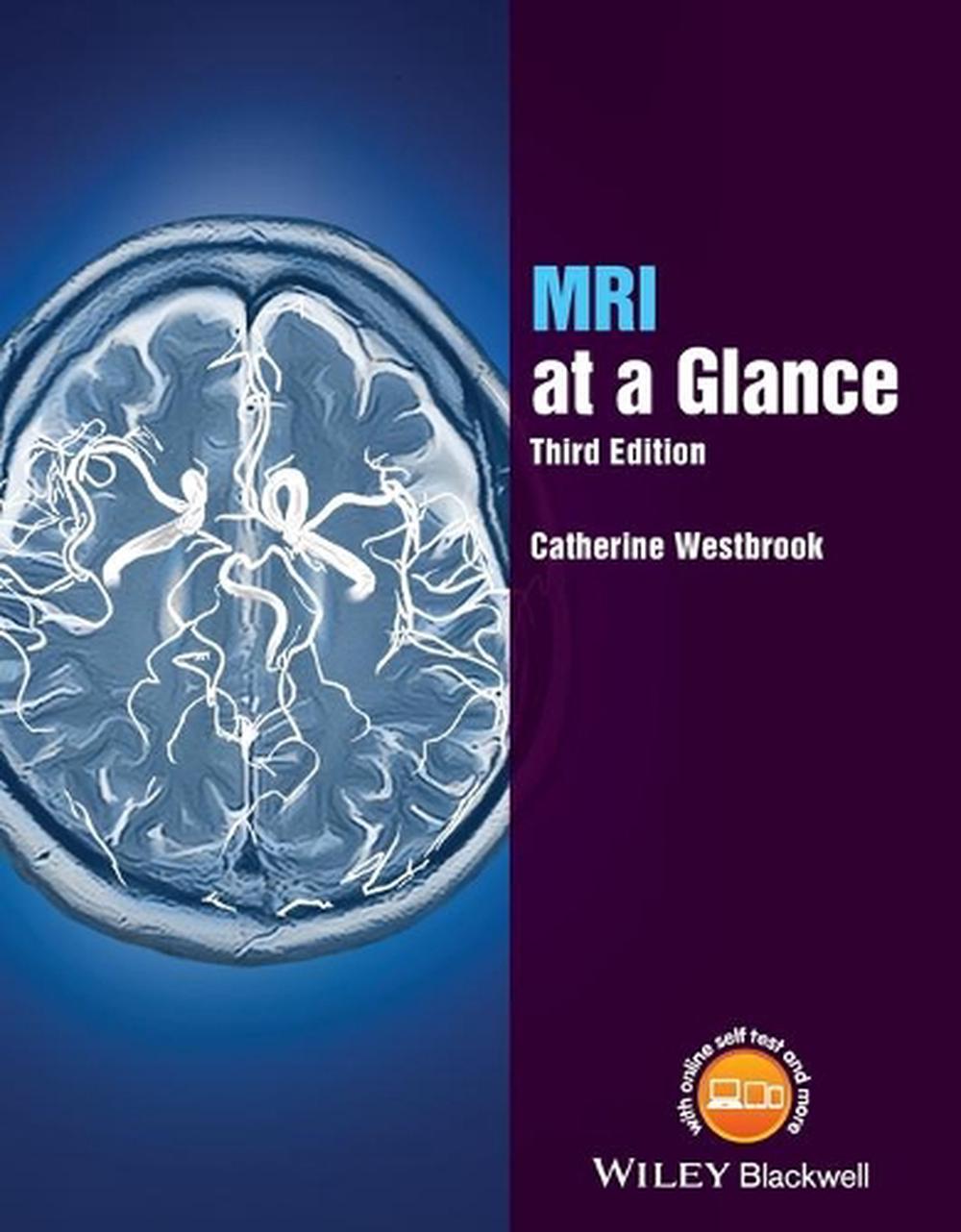 MRI at a Glance, 9781119053552