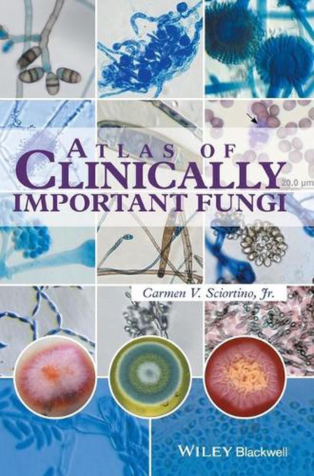 Atlas of Clinically Important Fungi, 9781119069669