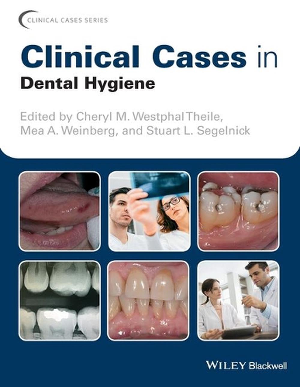 Clinical Cases in Dental Hygiene, 9781119145028