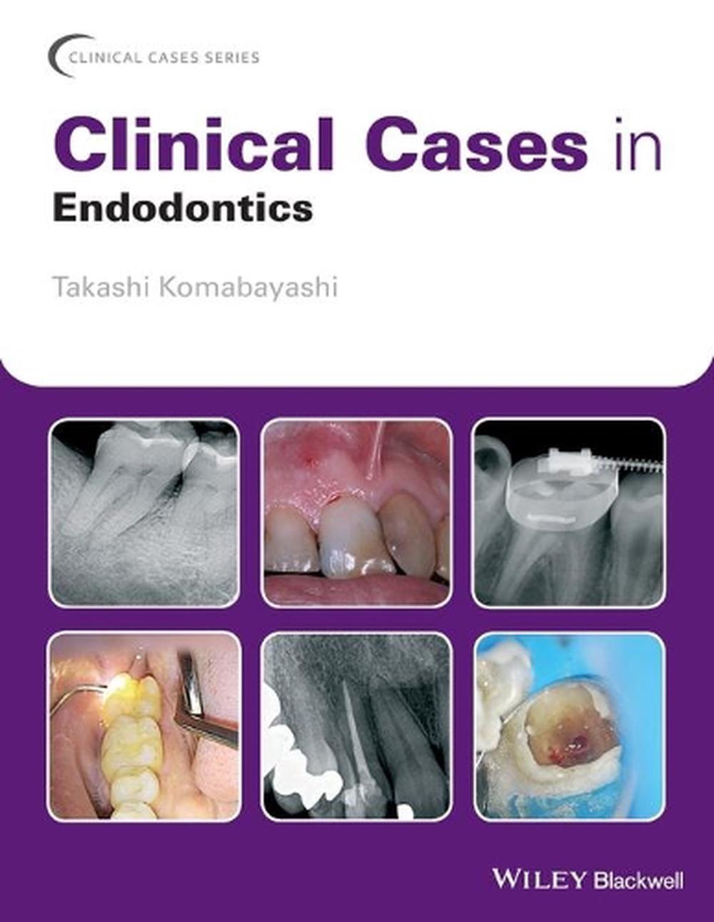 Clinical Cases in Endodontics, 9781119147046