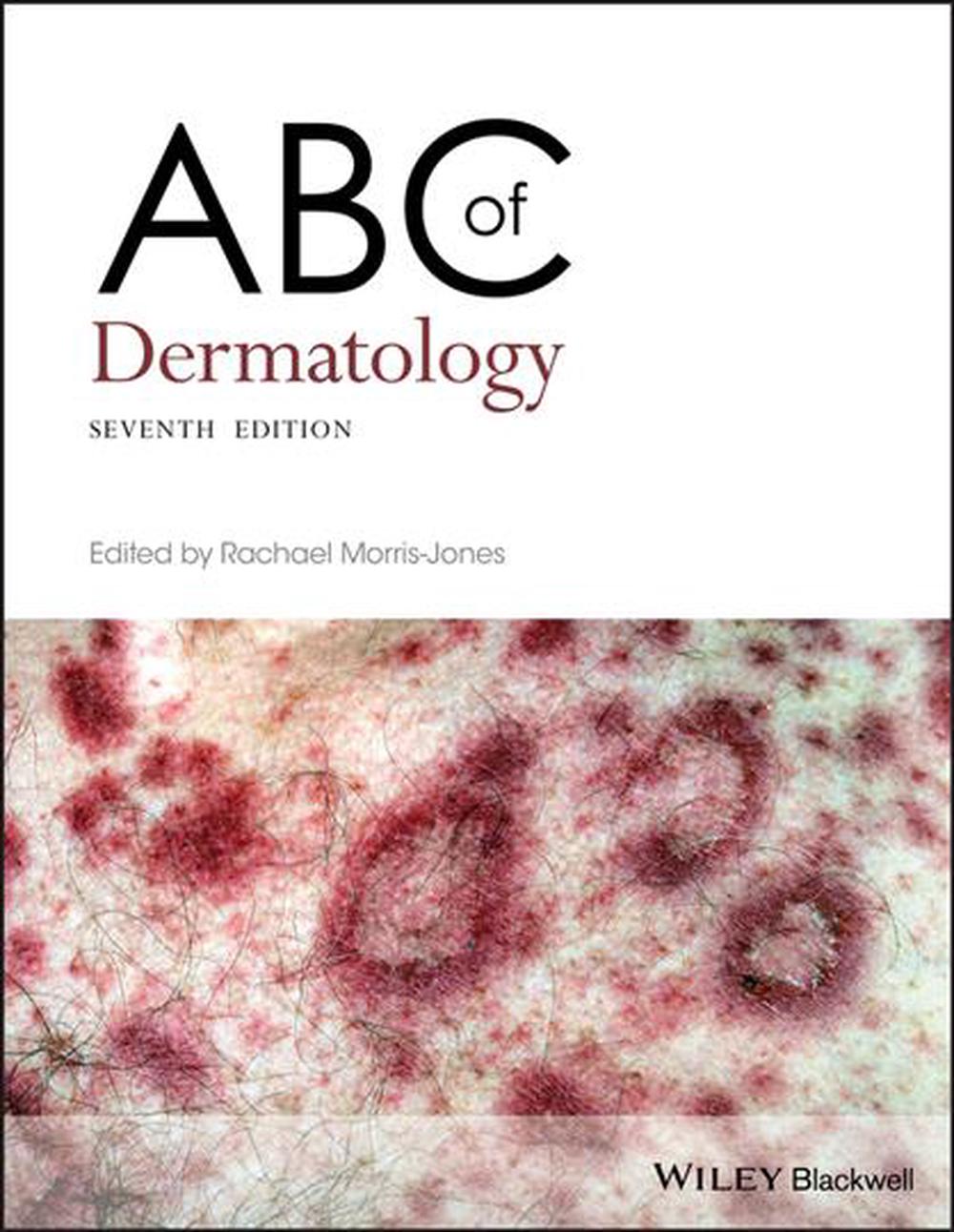 ABC of Dermatology, 9781119488989