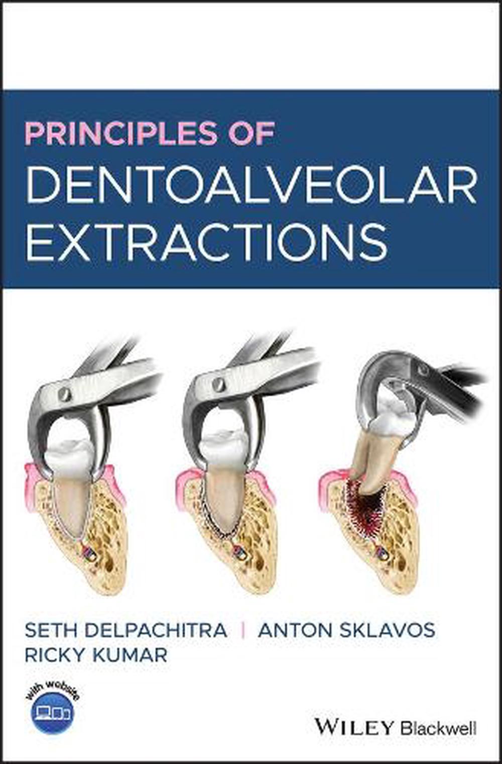 Principles of Dentoalveolar Extractions by Seth Delpachitra, Hardcover