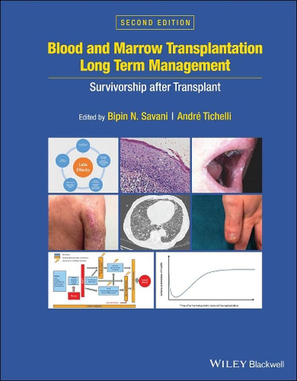 Blood and Marrow Transplantation Long Term Management, 9781119612698