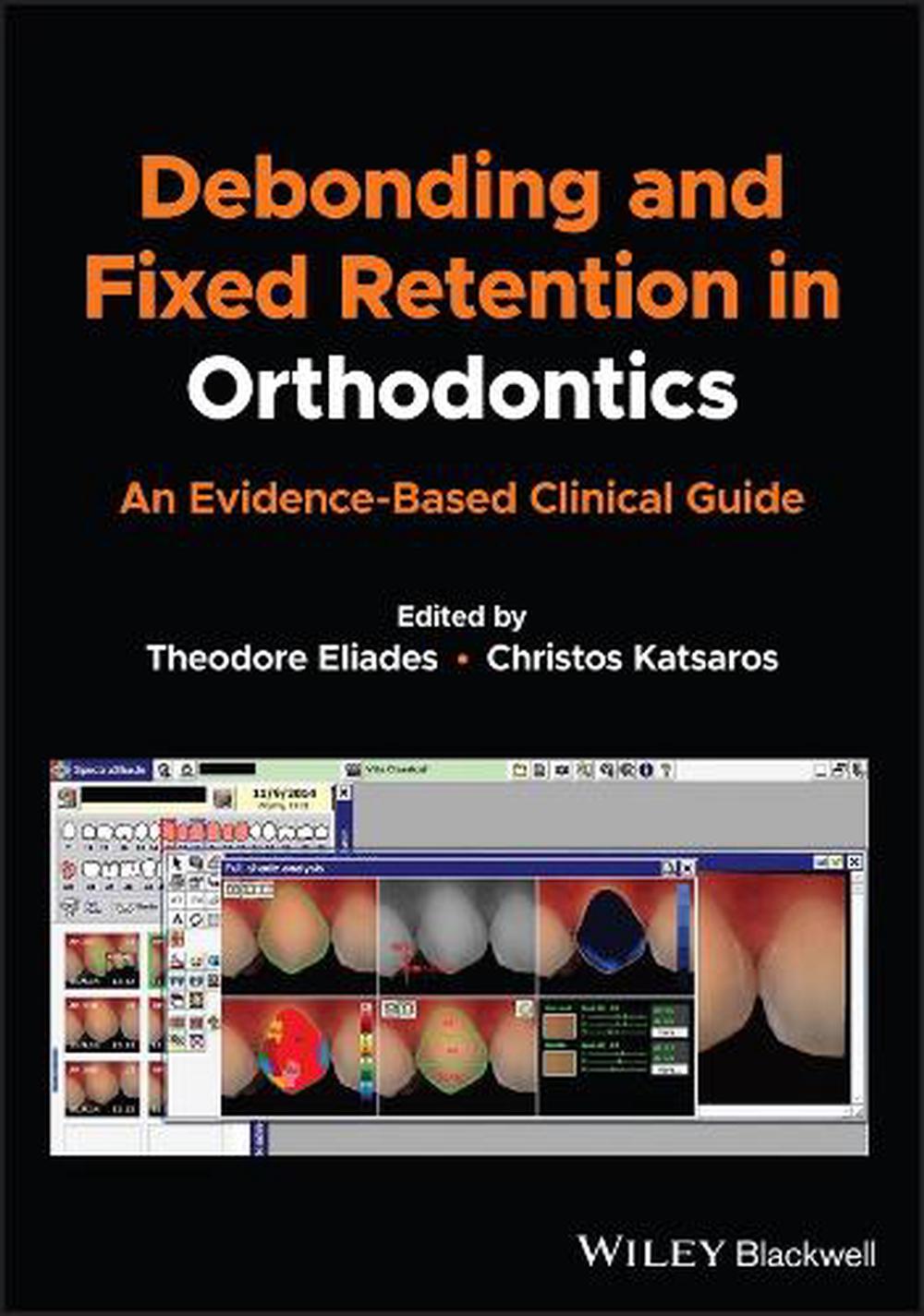 Debonding and Fixed Retention in Orthodontics, 9781119623953