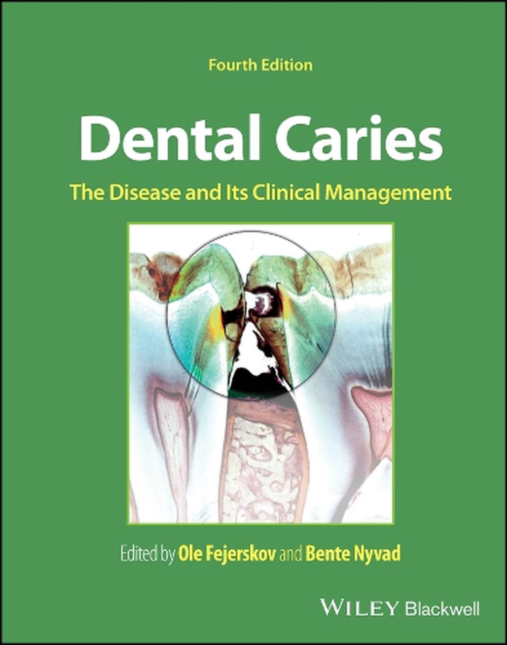 Dental Caries, 9781119679370