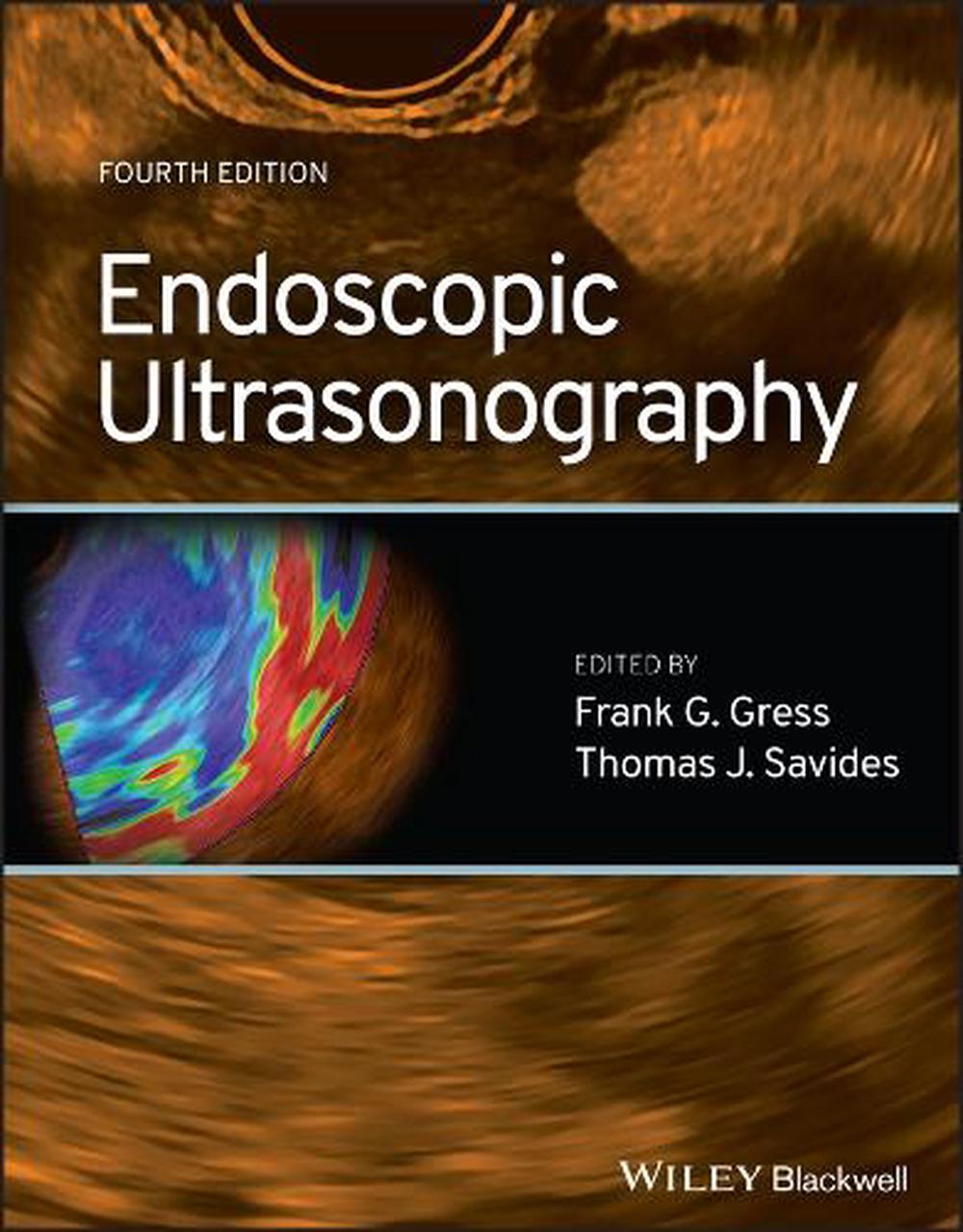 Endoscopic Ultrasonography, 9781119697916