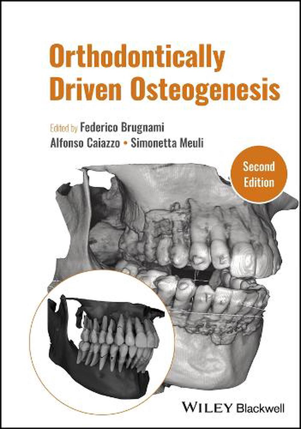 Orthodontically Driven Osteogenesis, 9781119700562
