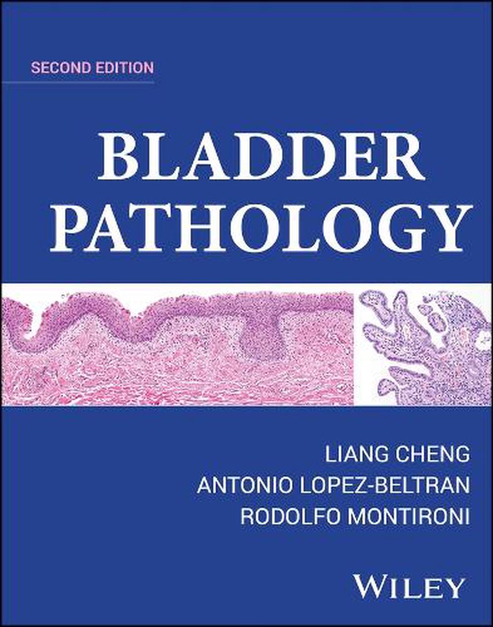 Bladder Pathology, 9781119707554