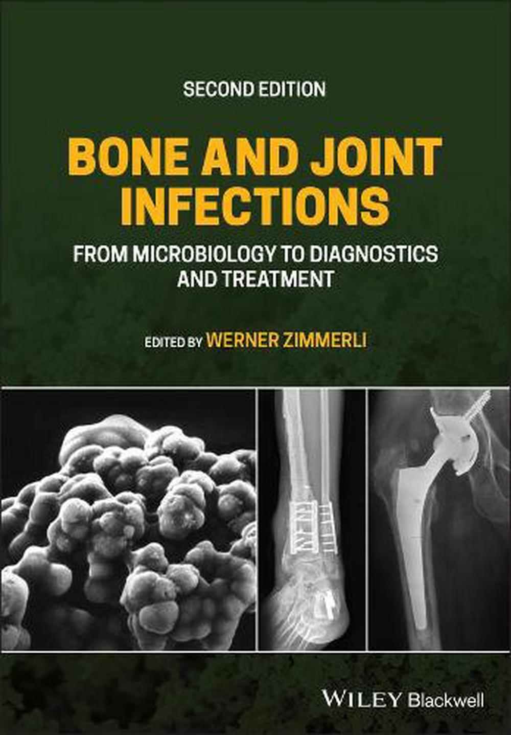 Bone and Joint Infections, 9781119720652
