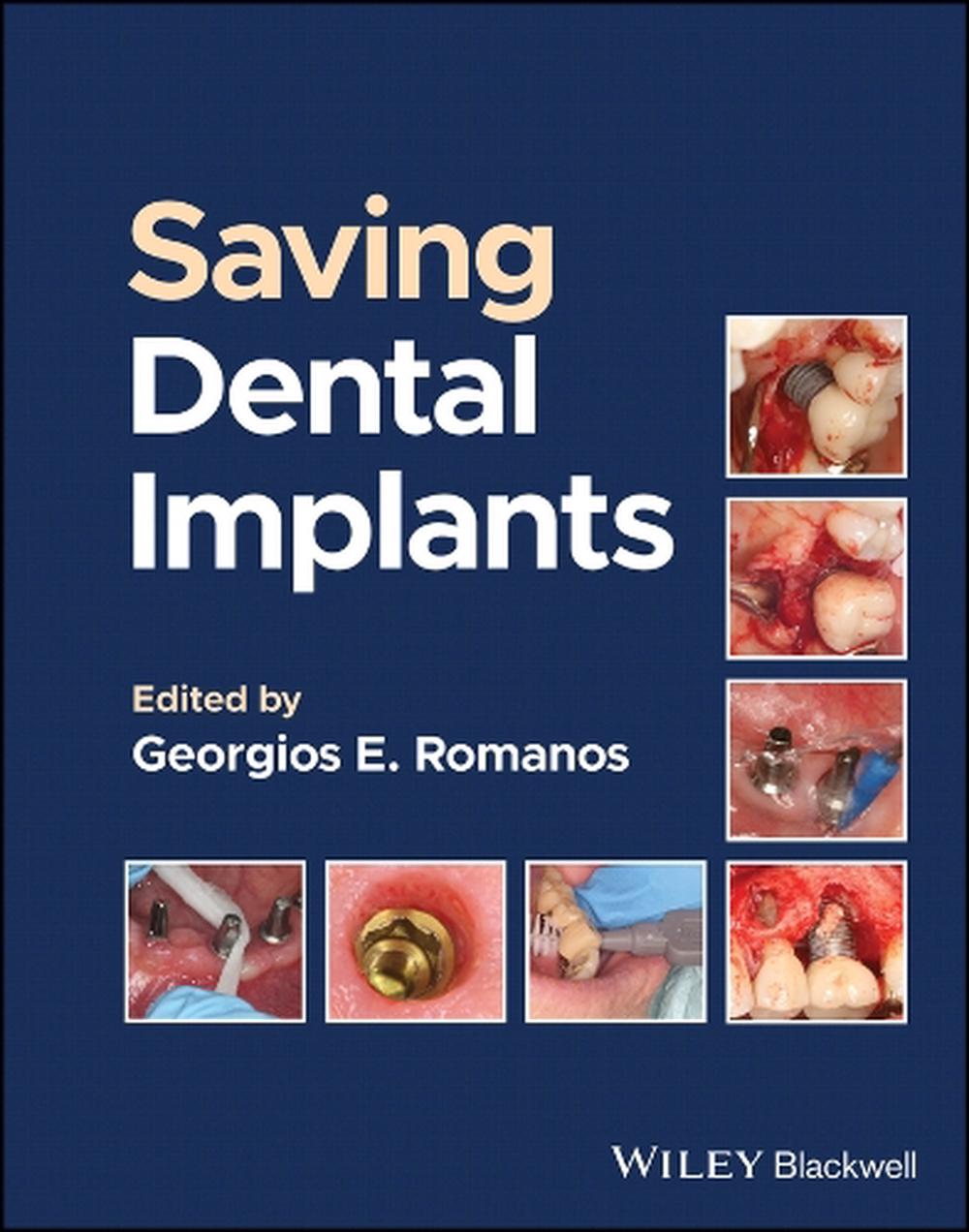 Saving Dental Implants, 9781119807018