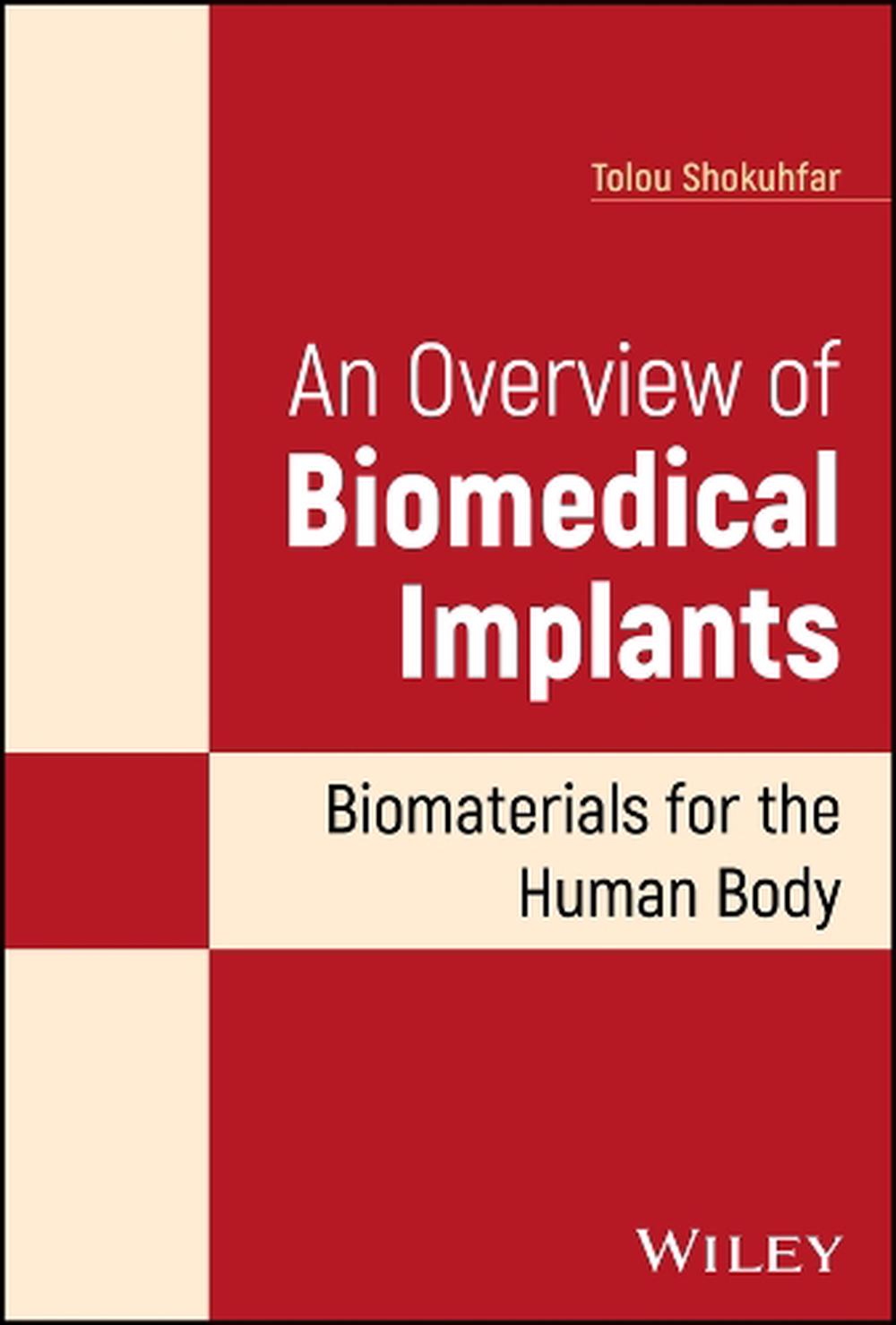 An Overview of Biomedical Implants, 9781119850977
