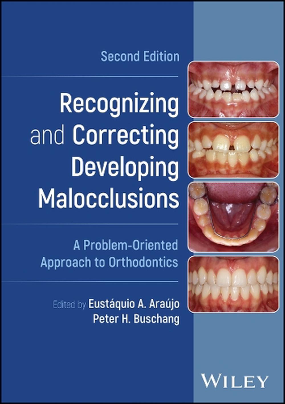 Recognizing and Correcting Developing Malocclusions, 9781119912545