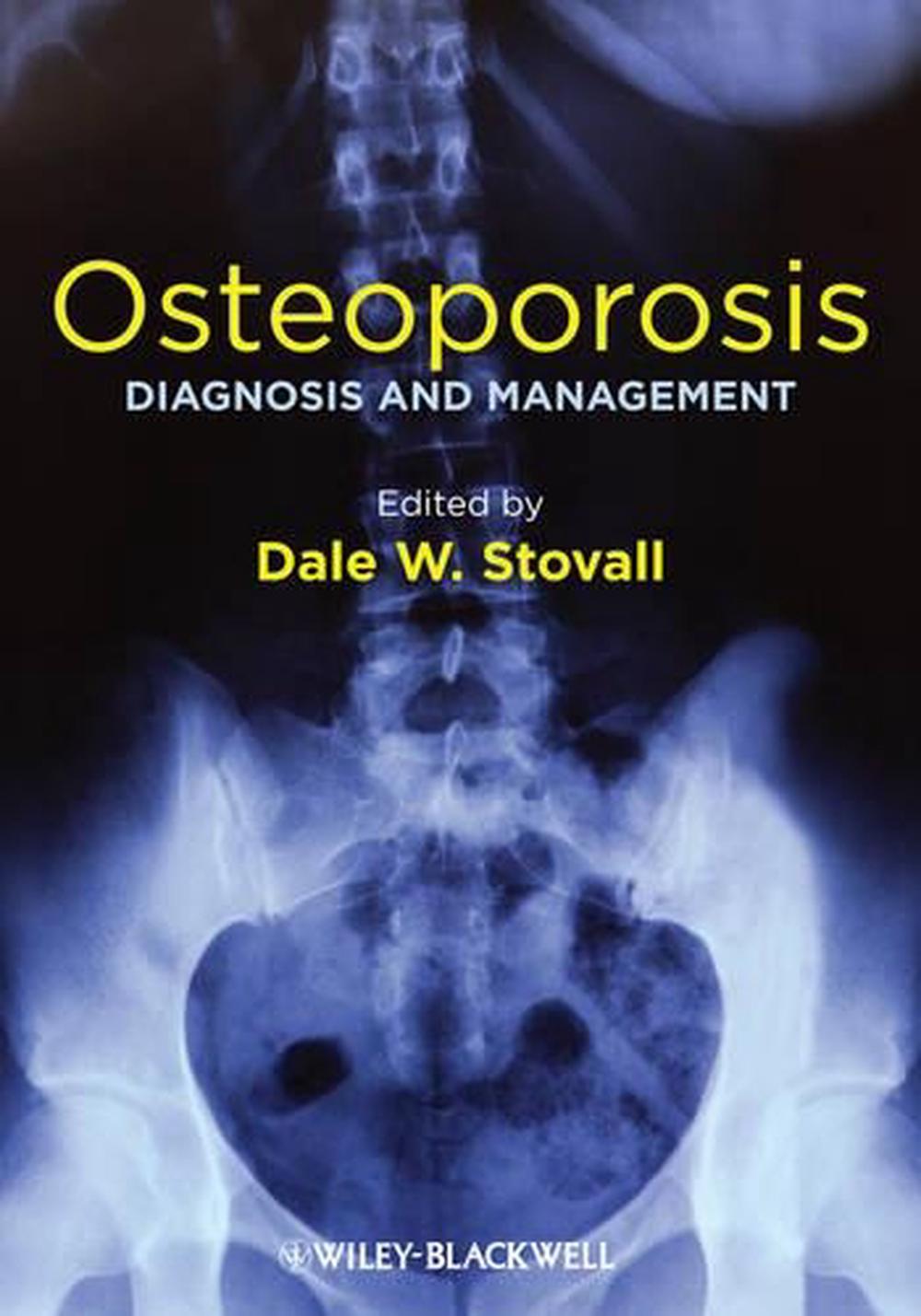 Osteoporosis, 2nd Edition, 9781119968917