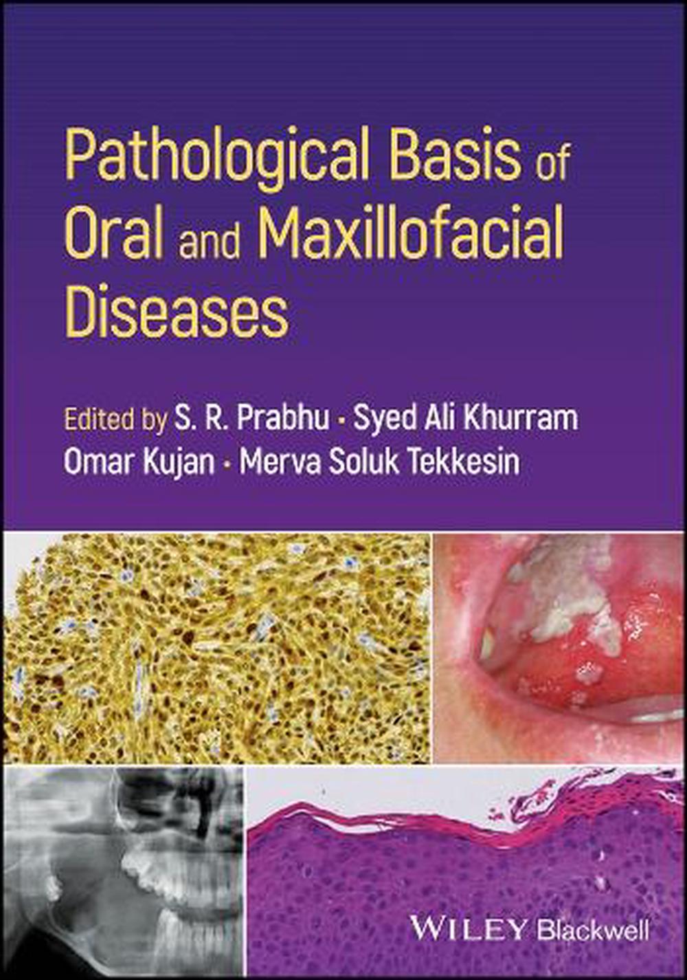 Pathological Basis of Oral and Maxillofacial Diseases, 9781119989202