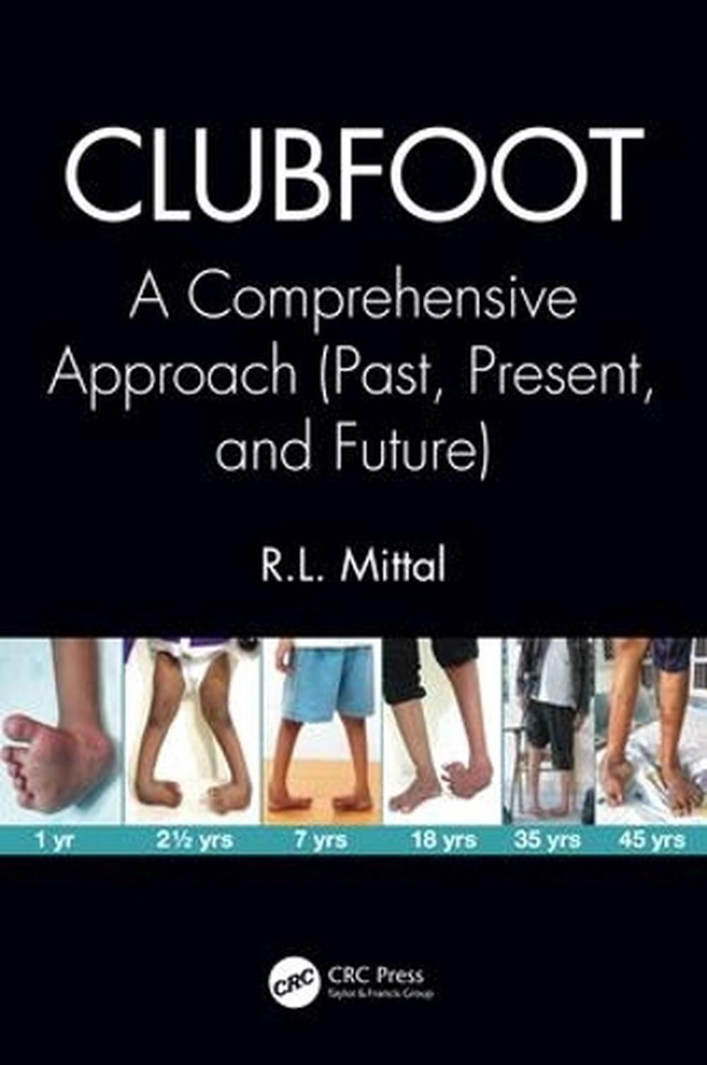 Clubfoot, 9781138083738