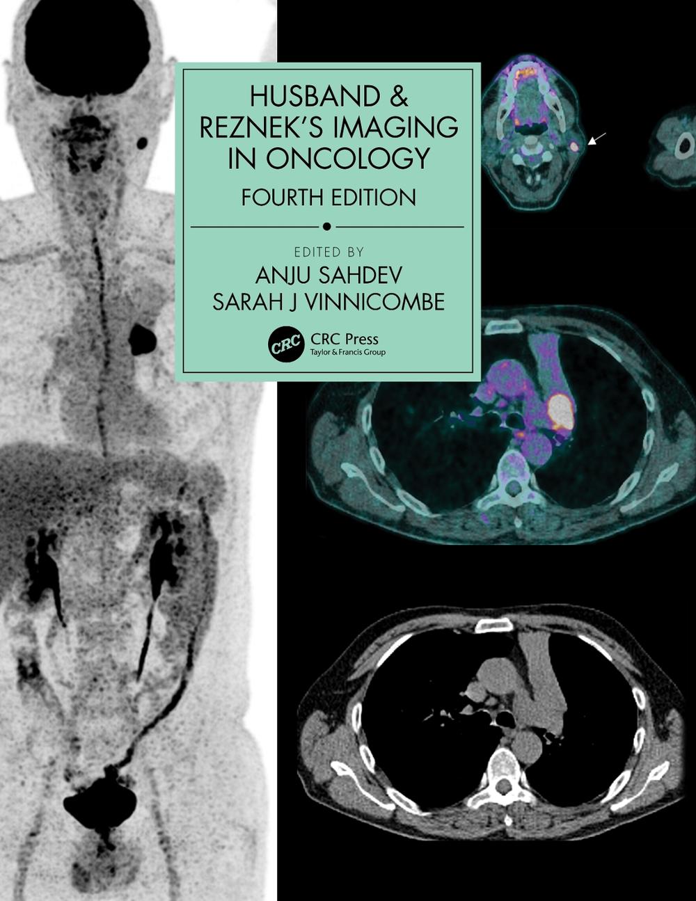 Husband & Reznek's Imaging in Oncology, 4th Edition, 9781138301238