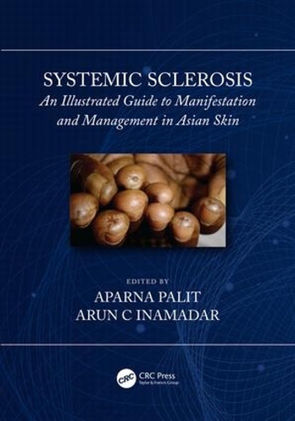 Systemic Sclerosis, 9781138480049