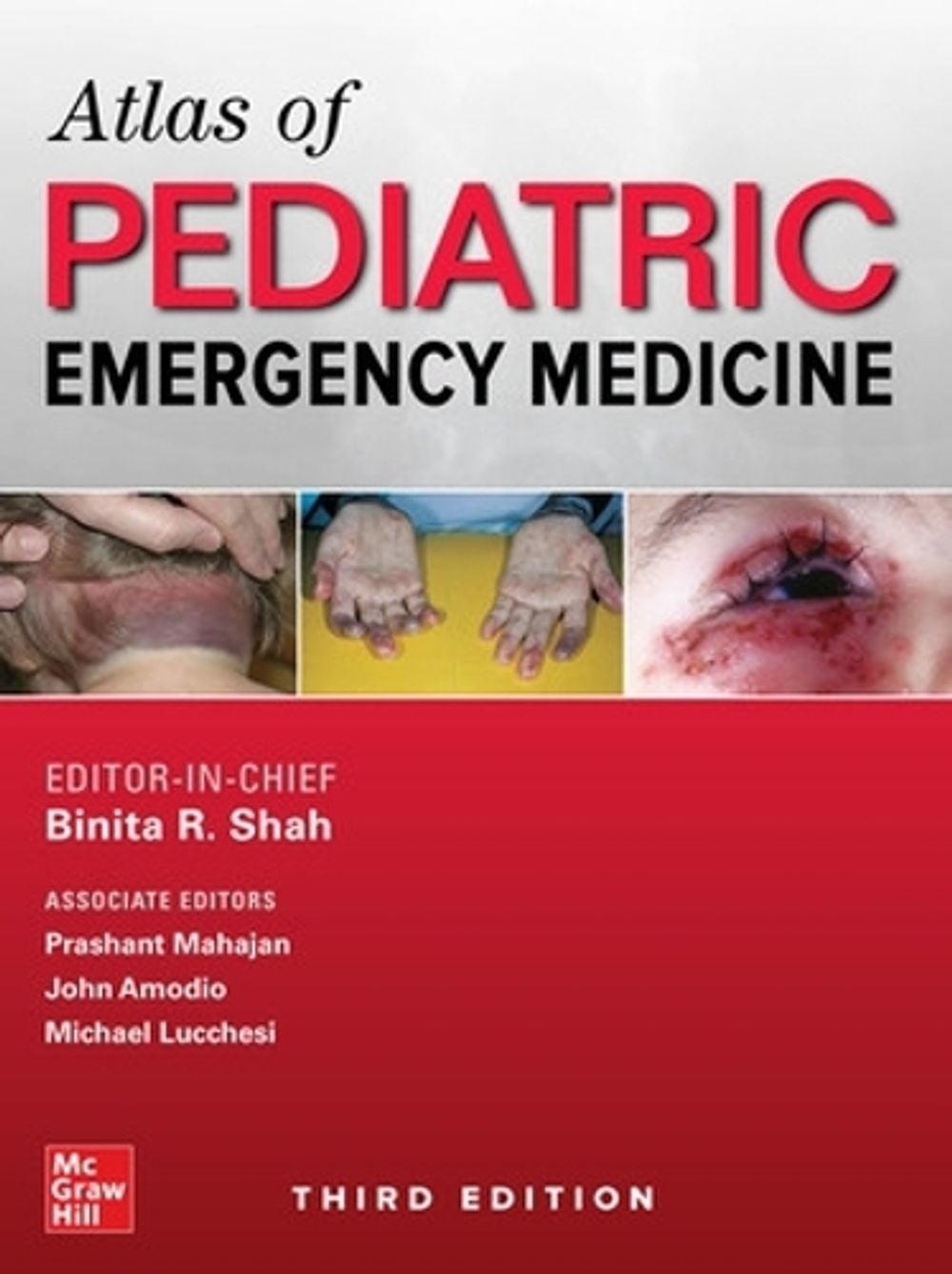 Atlas of Pediatric Emergency Medicine, Third Edition, 3rd Edition by Michael Lucchesi - ISBN: 9781259863387