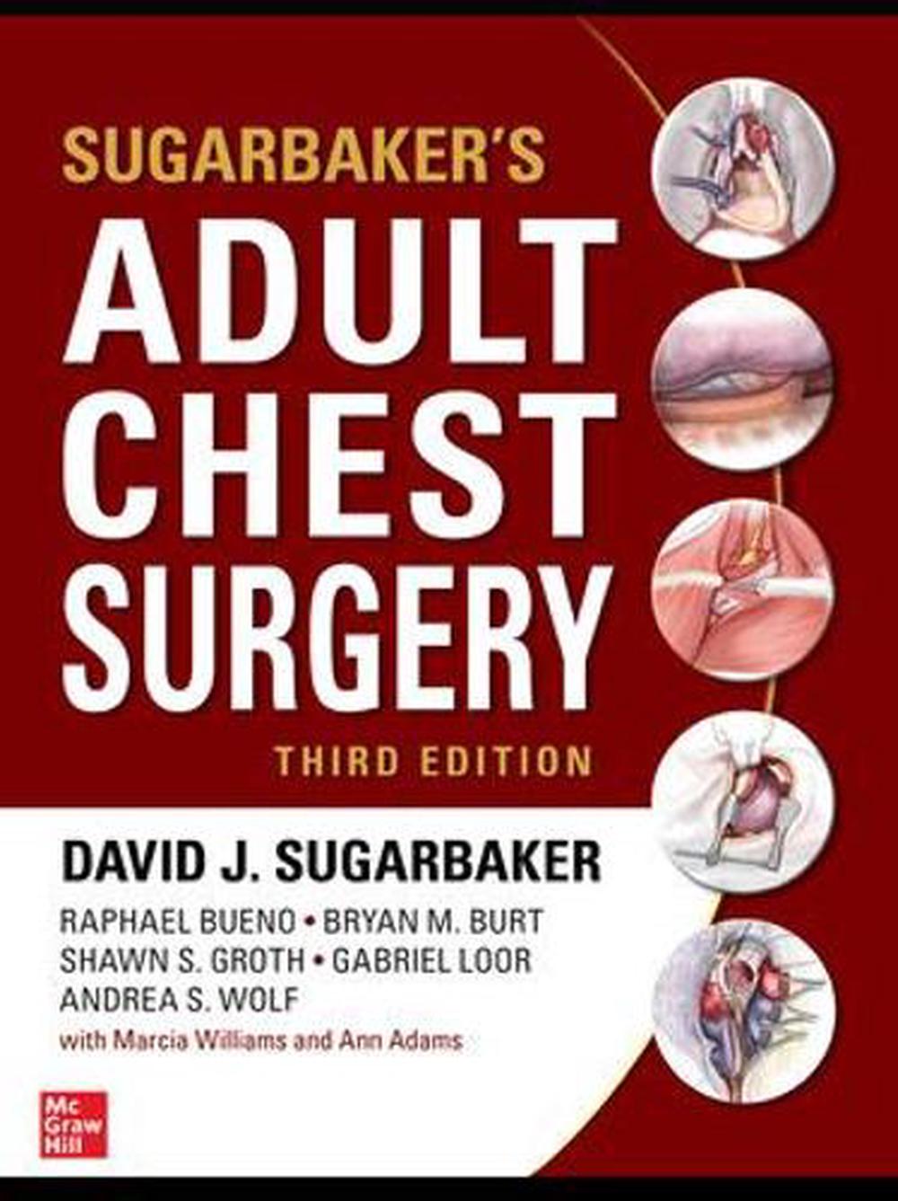 Sugarbaker's Adult Chest Surgery, 9781260026931