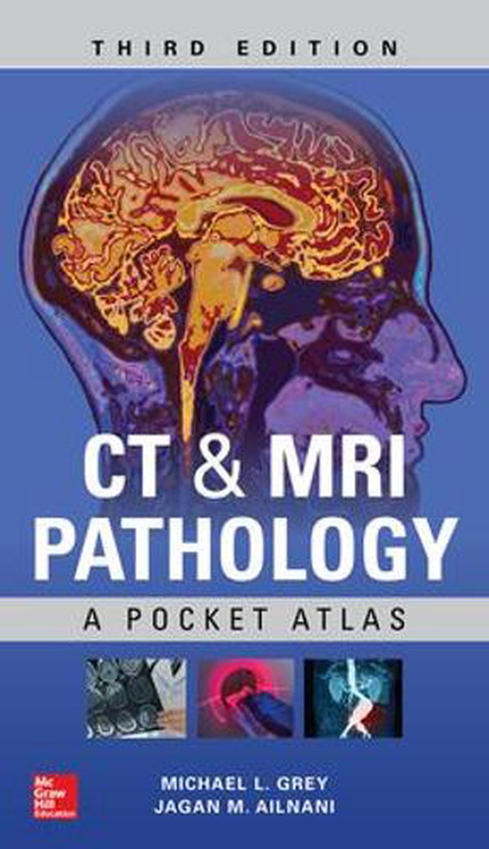 CT & MRI Pathology: A Pocket Atlas, Third Edition, 9781260121940